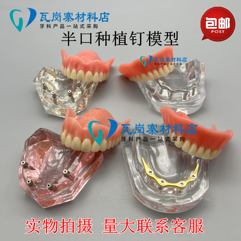 牙科模型口腔种植模型种植体解说义齿修复对比种植钉球帽杆卡导板