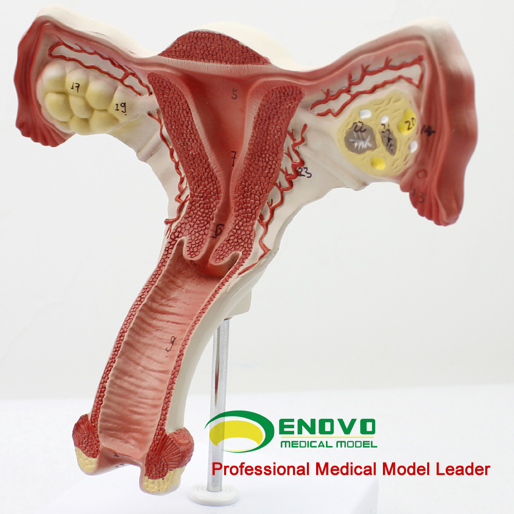 颐诺正品人体医用女性子宫模型卵巢生殖结构解剖模型妇科妇产科