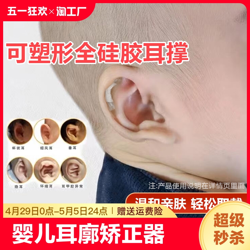 婴儿耳廓矫正器宝宝耳朵定型器贴纠正塑型外耳垂定耳撑塑形有效