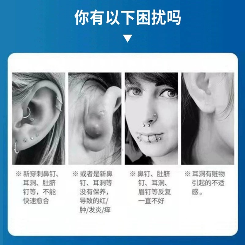 速发耳洞增生疙瘩护理液耳朵发炎专用药清洁消炎疤痕增生凸起去除