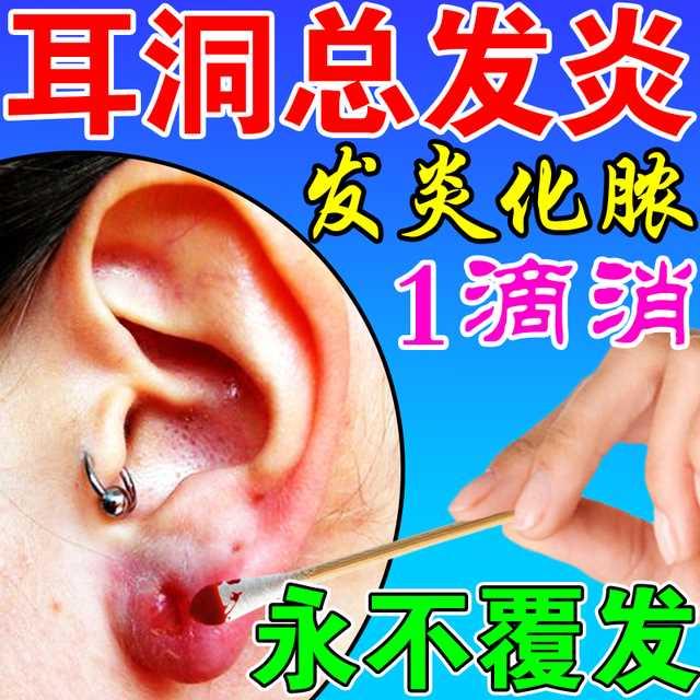 耳洞护理消炎液治增生疙瘩防耳朵痒发炎红肿流脓止痒抑菌清洁神器