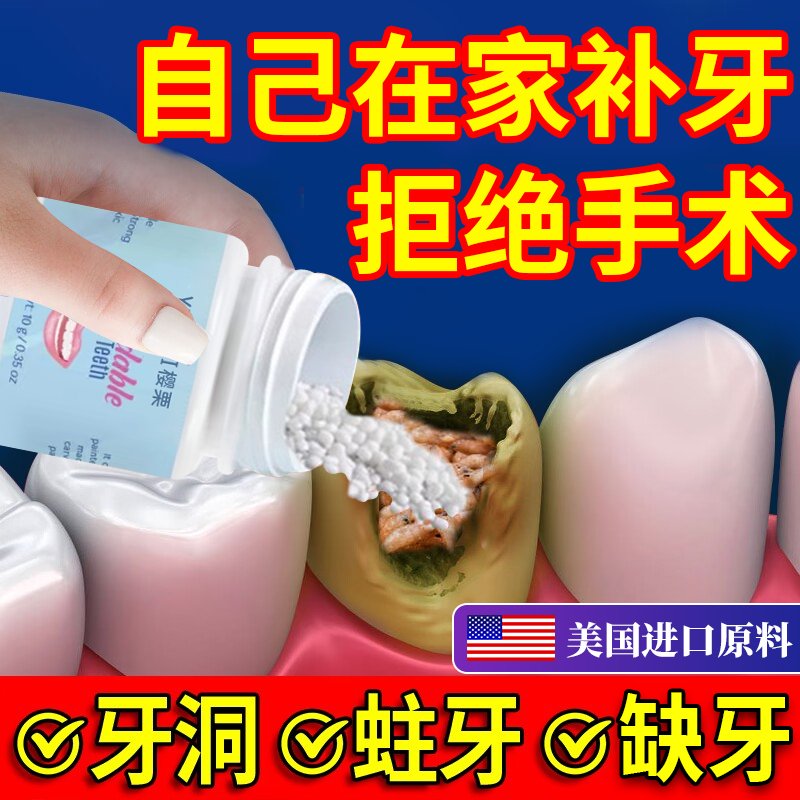 补牙神器自己在家补牙齿洞膏非永久修复烂蛀假牙缝填充剂树脂材料