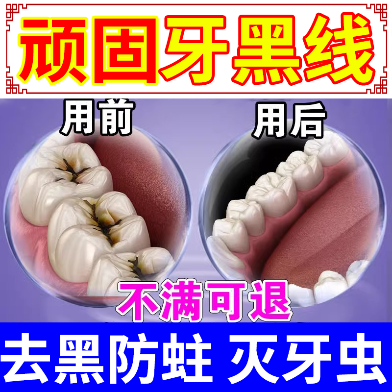牙膏防蛀抗敏含氟成人儿童龋齿修复告别蛀牙虫洞牙齿黑窟窿牙缝cr