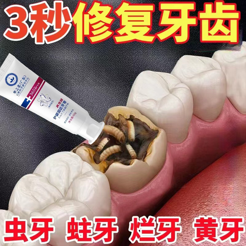 【日本研发】防蛀牙虫洞 牙齿黑窟窿黑牙线 防蛀牙牙洞坏牙买3送2
