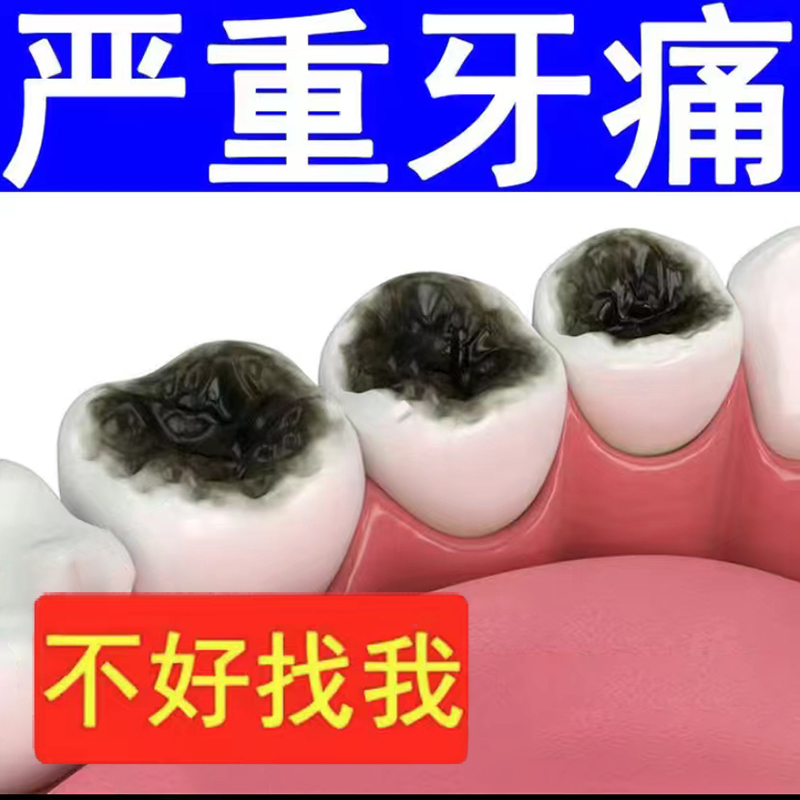 【护龈固齿】防蛀牙虫洞 牙齿黑窟窿黑牙线 防蛀牙牙洞坏牙买3送2