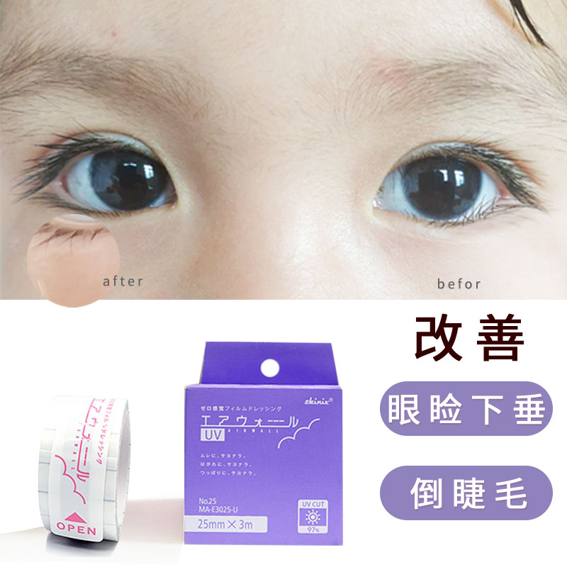 日本儿童倒睫毛矫正贴上眼睑下垂胶带提拉眼皮松弛神器婴儿零感觉