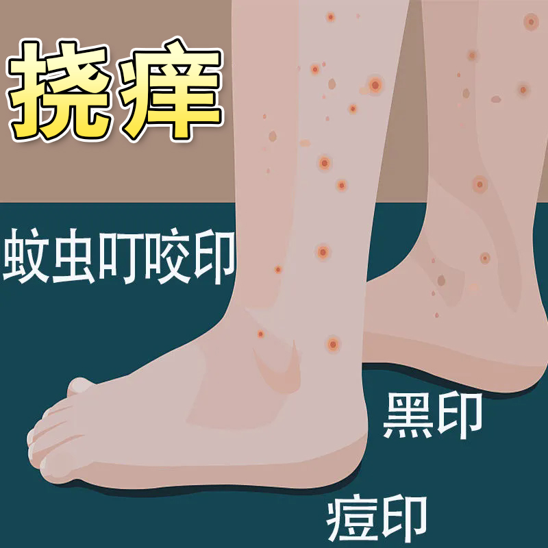 祛疤印淡化黑色素蚊虫叮咬去黑印疤痕印淡化腿上黑色素修复按摩膏