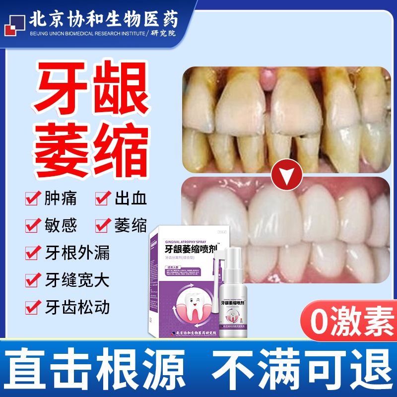 牙龈萎缩修复再牙肉生专用牙膏漱口水牙周炎口腔医用防的喷剂IR