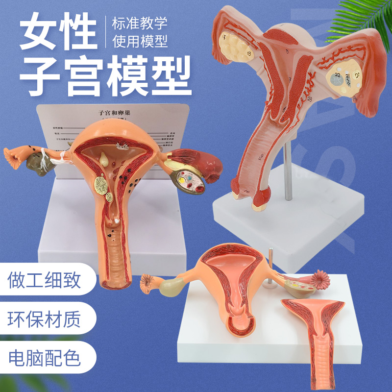 医学女性子宫模型卵巢生殖结构解剖模型妇科妇产科卵巢子宫模型