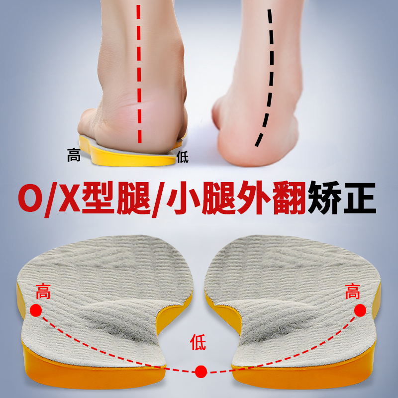 XO型腿神器人体工学矫正鞋垫小腿肌肉外翻外侧磨损走路姿势纠正垫