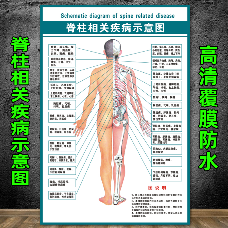 人体脊柱相关疾病示意图中医养生脊椎病理原因结构图挂图海报挂画