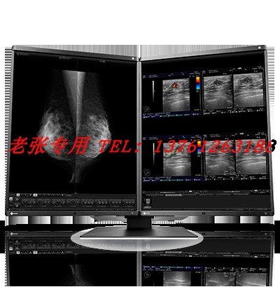 EIZO/艺卓RadiForce RX250 RX340 3M彩色灰阶乳腺黑白液晶显示器