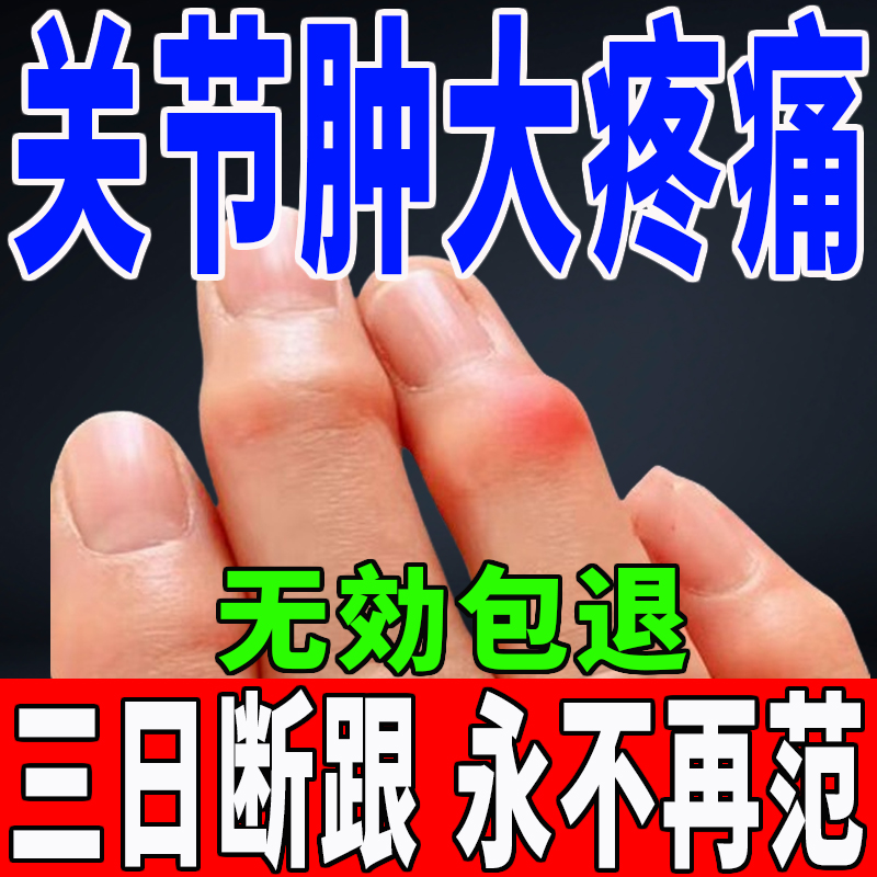 内风湿手指关节变形肿大粗疼痛酸麻僵硬药专用药腱鞘炎痛风消结晶