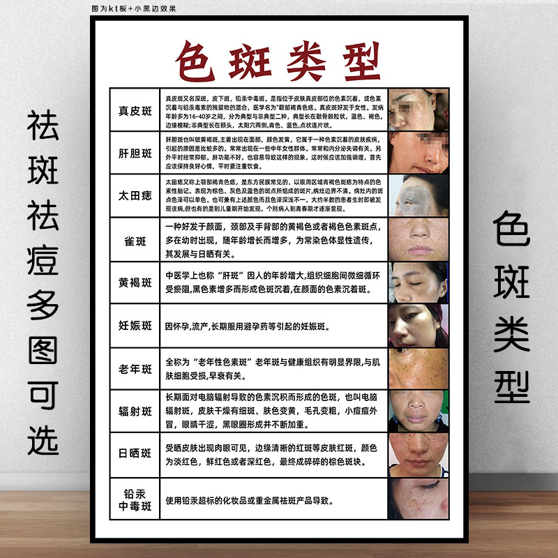 面部色斑类型宣传画祛斑祛痘广告图雀斑问题肌肤挂画皮肤管理海报