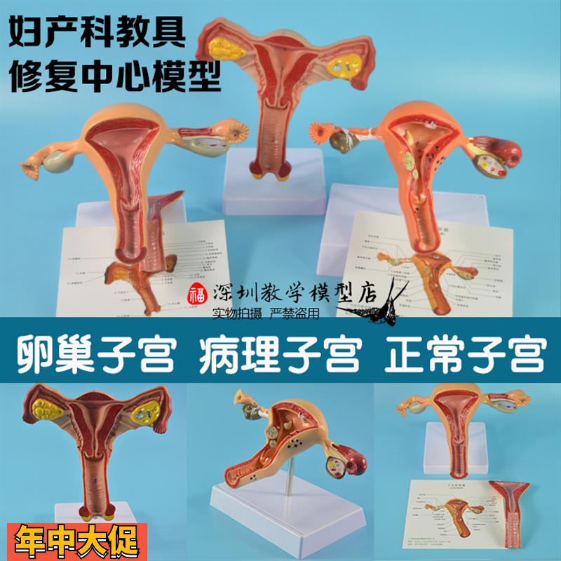 产后修复中心内生殖系统展示模型女性正常卵巢/病理子宫解剖模型