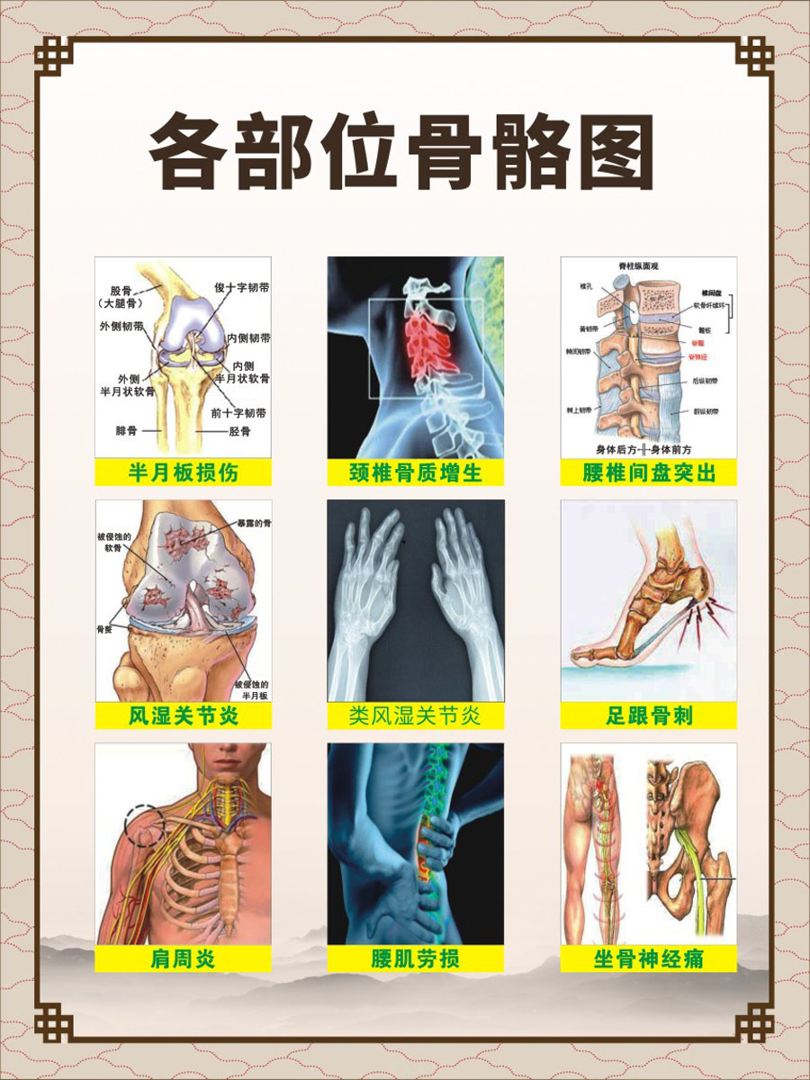 770人体各部位骨骼图关节颈椎腰椎足跟示意结构图566海报印制展板