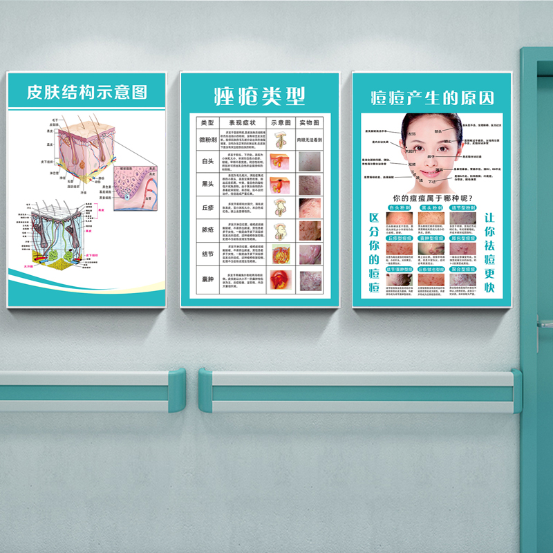 医疗诊所皮肤结构示意图痤疮痘痘产生的原因美容院宣传画广告海报