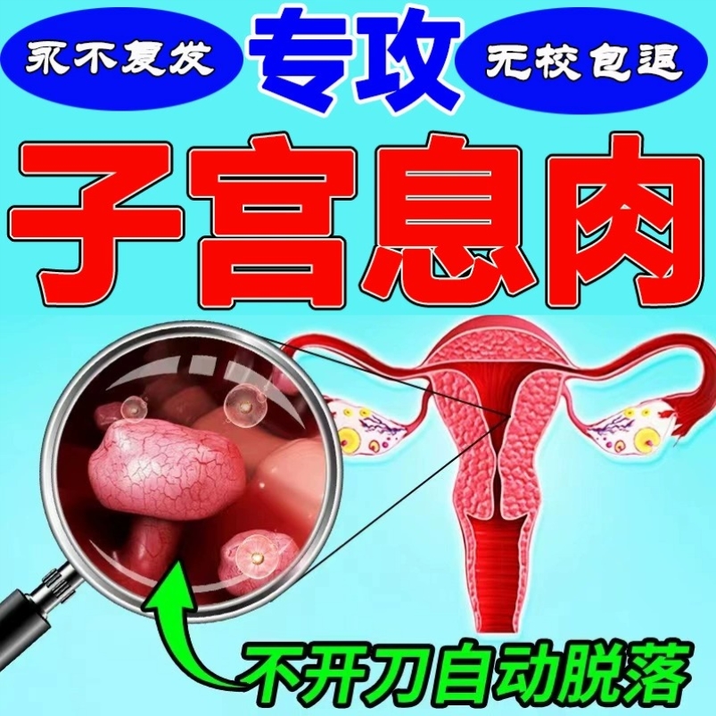 子宫腔内膜息肉中药去除宫颈肥大宫腔太厚内膜薄增厚中药抑菌凝胶