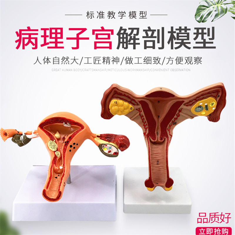 医学人体模型女性生殖病理子宫仿真病变子宫解剖卵巢模型妇科教具