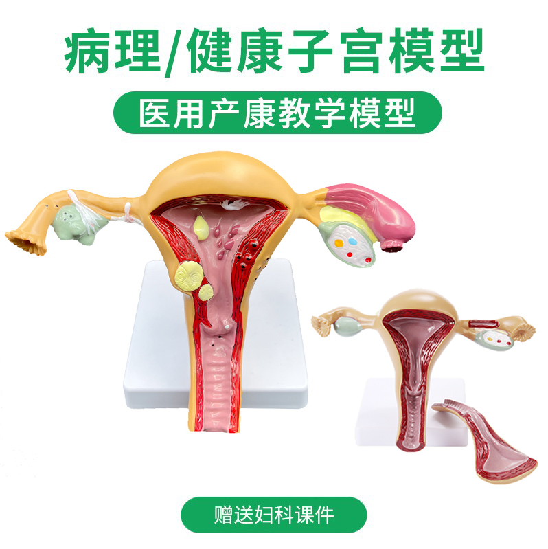 子宫卵巢模型病变生殖科妇科医用演示阴道结构解剖模具女性人体