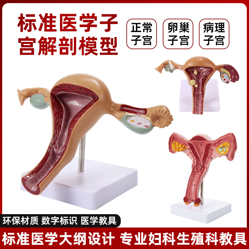 人体子宫卵巢附件女性生殖器阴道病理变结构解剖模型医学教学模具
