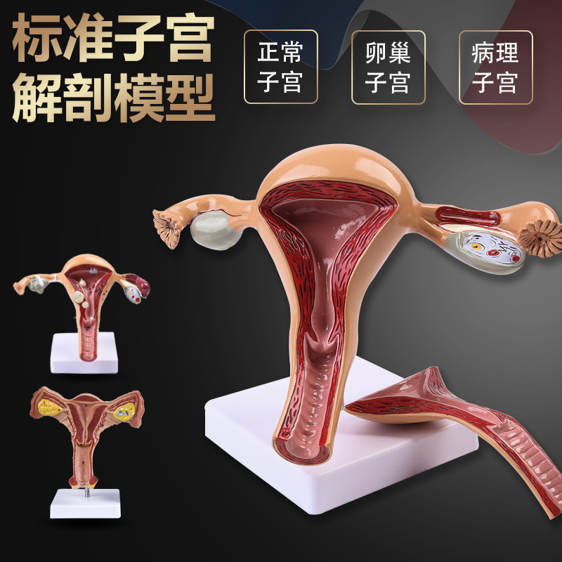 人体模型女性生殖子宫模型医院用病变子宫模型教具妇科解剖卵巢