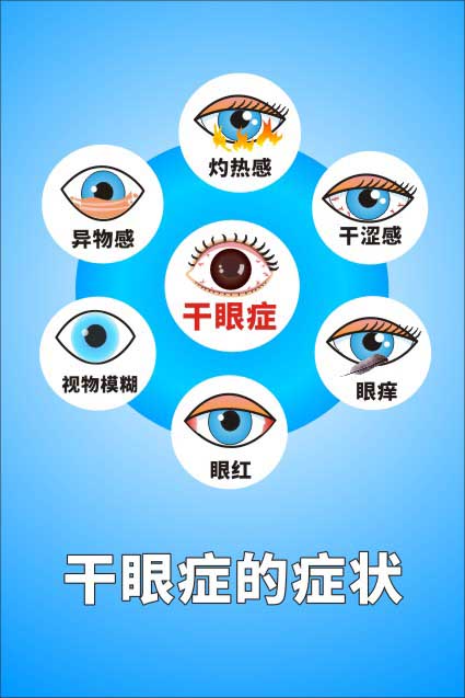 M771眼睛干眼症各种症状眼球结构示意图海报定印制展板贴纸1294