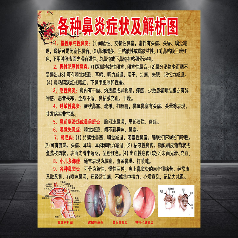 鼻炎种类特征及解析图海报宣传画广告贴图片挂画图墙壁画1086