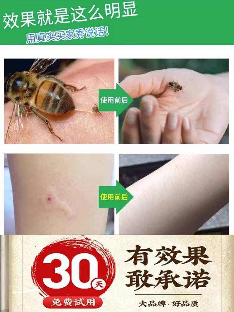 新品马蜂蜜蜂蛰伤药膏人被叮咬止痒止疼痛蜇消肿杀菌特效专用神器