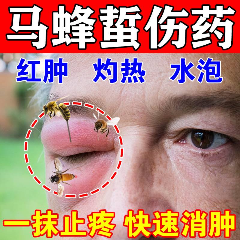 马蜂蛰伤药膏蜜蜂蜂王叮咬止痒消肿疼养蜂专用工具被蜜蜂蛰伤的药