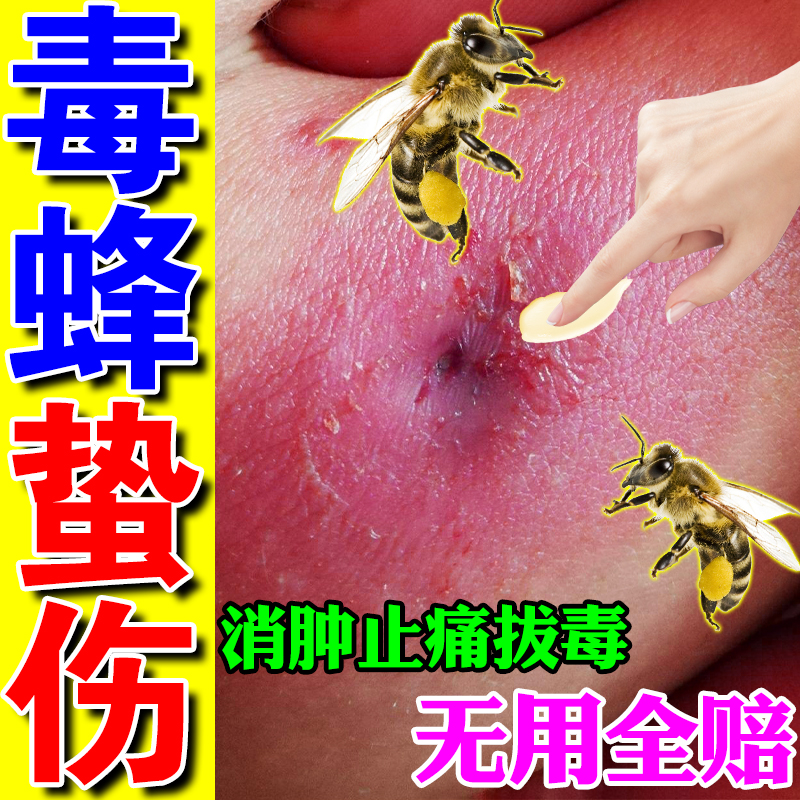 马蜂蛰伤药膏蜜蜂蛰伤胡峰叮咬消肿止痒拔毒养蜂专用工具一喷灵膏