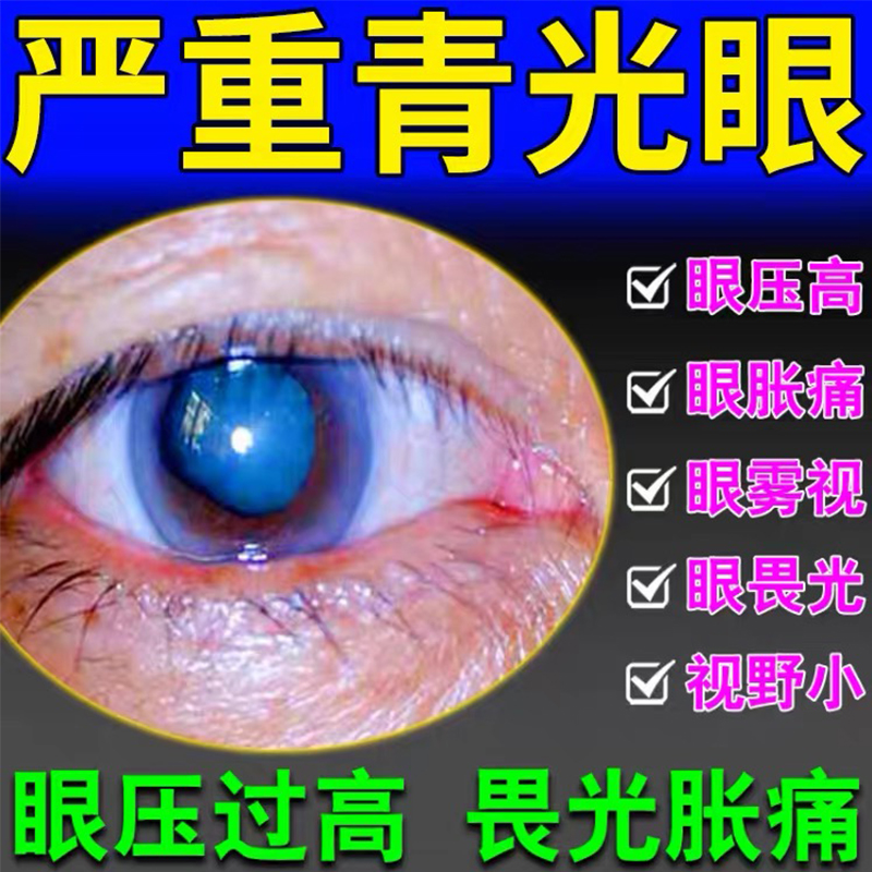 酒石酸溴莫尼定滴眼液可安明开角型青光眼降眼压高眼压眼药水特效