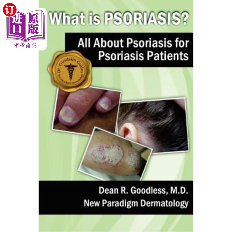 海外直订医药图书What is Psoriasis?: All About Psoriasis for Psoriasis Patients 什么是牛皮癣？：关于银屑病患者的所有